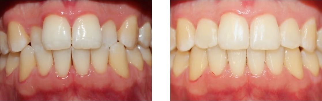 Efekt leczenia 9