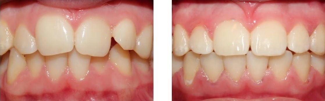 Efekt leczenia 10