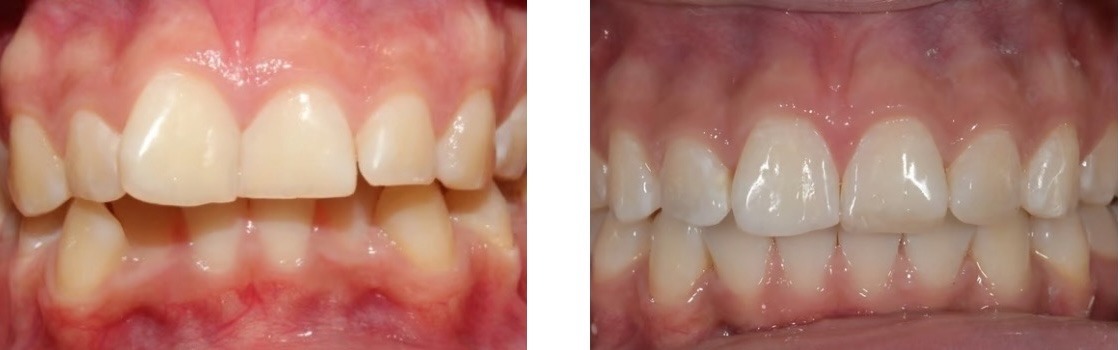 Efekt leczenia 11