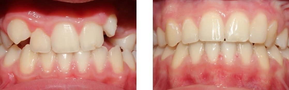 Efekt leczenia 13