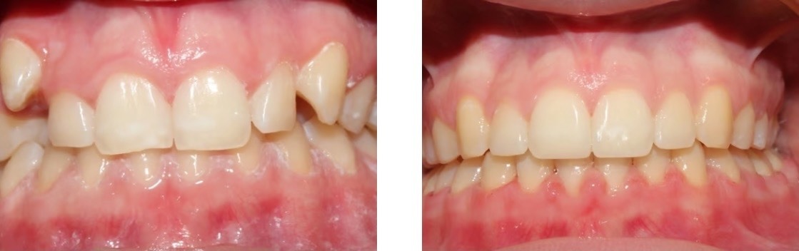 Efekt leczenia 15