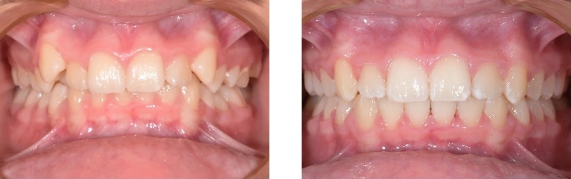 Efekt leczenia 6
