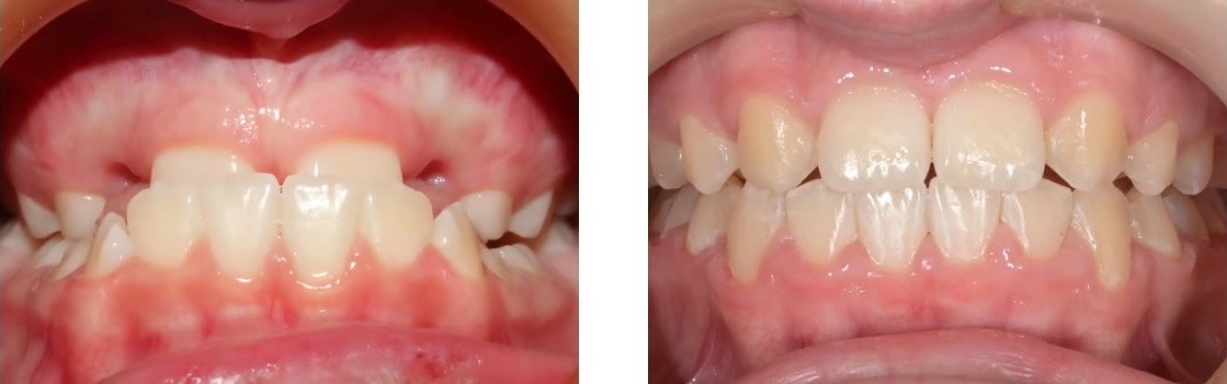 Efekt leczenia 7