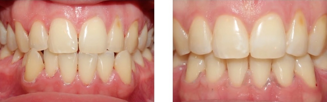 Efekt leczenia 8